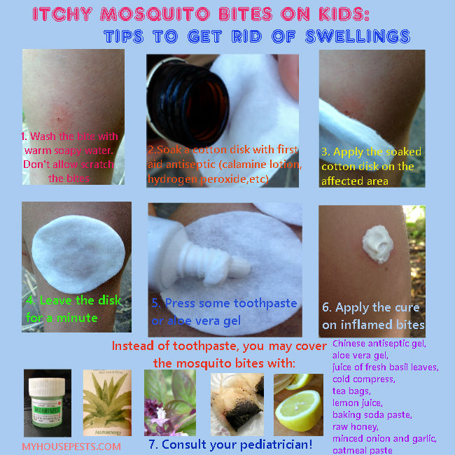 How to treat mosquito bites on kids