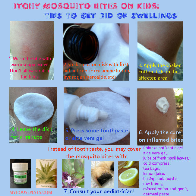 mosquito bite cream for babies