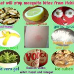 What will stop mosquito bites from itching?