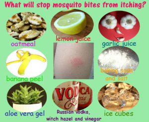 What will stop mosquito bites from itching