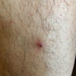 Viral tick-borne illnesses that occur in the United States